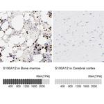 S100A12 Antibody