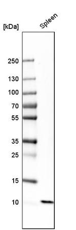 S100A12 Antibody in Western Blot (WB)