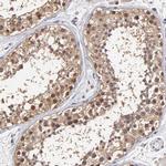 PSMD10 Antibody in Immunohistochemistry (IHC)