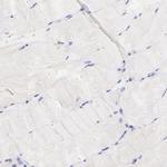 Lrmp Antibody in Immunohistochemistry (IHC)