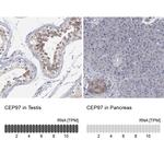 CEP97 Antibody in Immunohistochemistry (IHC)