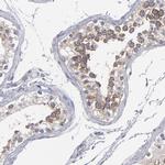 CEP97 Antibody in Immunohistochemistry (IHC)