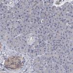 CEP97 Antibody in Immunohistochemistry (IHC)