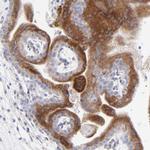 LHFPL1 Antibody in Immunohistochemistry (IHC)