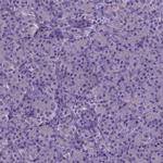 MLC1 Antibody in Immunohistochemistry (IHC)