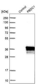 PBDC1 Antibody in Western Blot (WB)