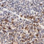 MED12 Antibody in Immunohistochemistry (IHC)