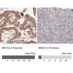 MED12 Antibody