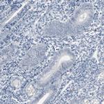 SAGE1 Antibody in Immunohistochemistry (IHC)