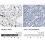 SAGE1 Antibody