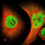 ZMYM3 Antibody in Immunocytochemistry (ICC/IF)