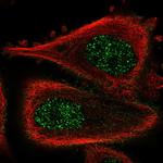 ABLIM3 Antibody in Immunocytochemistry (ICC/IF)