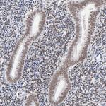 ZNF143 Antibody in Immunohistochemistry (IHC)