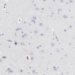 CD2AP Antibody in Immunohistochemistry (IHC)