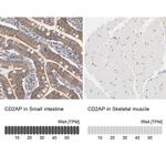 CD2AP Antibody