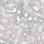 Optineurin Antibody in Immunohistochemistry (IHC)