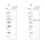 Optineurin Antibody in Western Blot (WB)