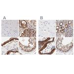 CD2AP Antibody in Immunohistochemistry (IHC)