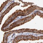 CD2AP Antibody in Immunohistochemistry (IHC)