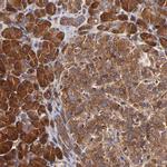 CD2AP Antibody in Immunohistochemistry (IHC)