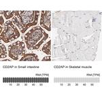 CD2AP Antibody