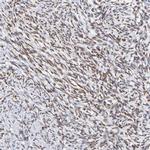 ZNF74 Antibody in Immunohistochemistry (IHC)