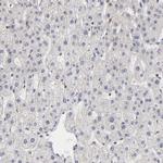 BRPF1 Antibody in Immunohistochemistry (IHC)