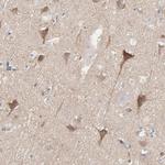 Optineurin Antibody in Immunohistochemistry (IHC)