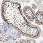 Optineurin Antibody in Immunohistochemistry (IHC)