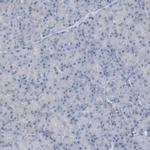 Optineurin Antibody in Immunohistochemistry (IHC)