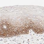 RPS21 Antibody in Immunohistochemistry (IHC)