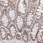 RPS21 Antibody in Immunohistochemistry (IHC)