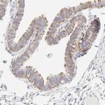 RPS21 Antibody in Immunohistochemistry (IHC)