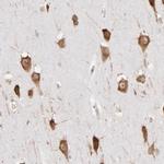 RPL9 Antibody in Immunohistochemistry (IHC)