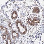 RPL9 Antibody in Immunohistochemistry (IHC)