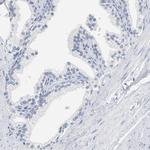 ZCCHC13 Antibody in Immunohistochemistry (IHC)