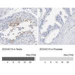 ZCCHC13 Antibody