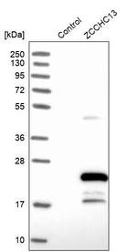 ZCCHC13 Antibody in Western Blot (WB)