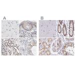 Nesprin 2 Antibody in Immunohistochemistry (IHC)