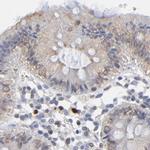 Nesprin 2 Antibody in Immunohistochemistry (IHC)