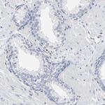 PAGE1 Antibody in Immunohistochemistry (IHC)