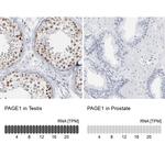 PAGE1 Antibody