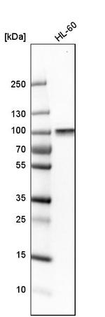 ARHGEF6 Antibody in Western Blot (WB)