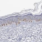 GPR143 Antibody in Immunohistochemistry (IHC)