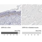 GPR143 Antibody