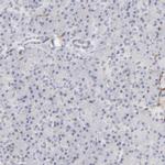 WIPF1 Antibody in Immunohistochemistry (IHC)