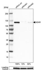 ADAR Antibody