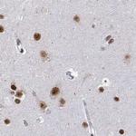 ADAR Antibody in Immunohistochemistry (IHC)