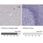 PCSK1N Antibody in Immunohistochemistry (IHC)