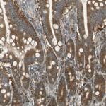 RARS Antibody in Immunohistochemistry (IHC)